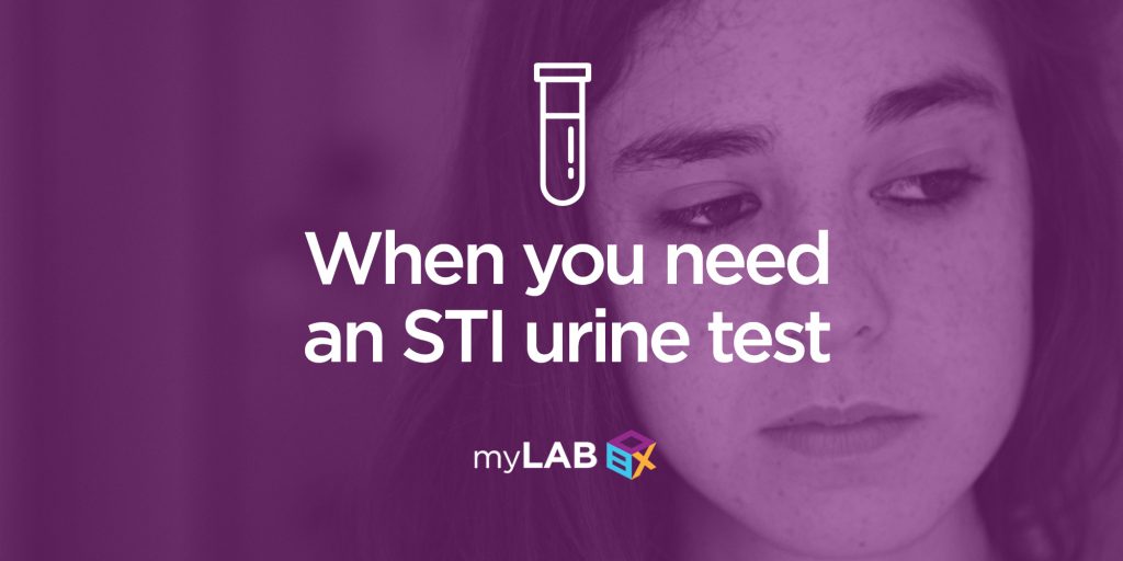 When You Need An STI Urine Test