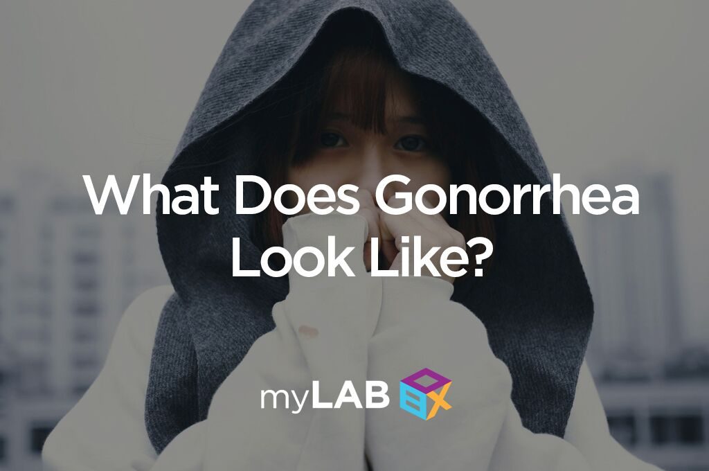 What Does Gonorrhea Look Like?