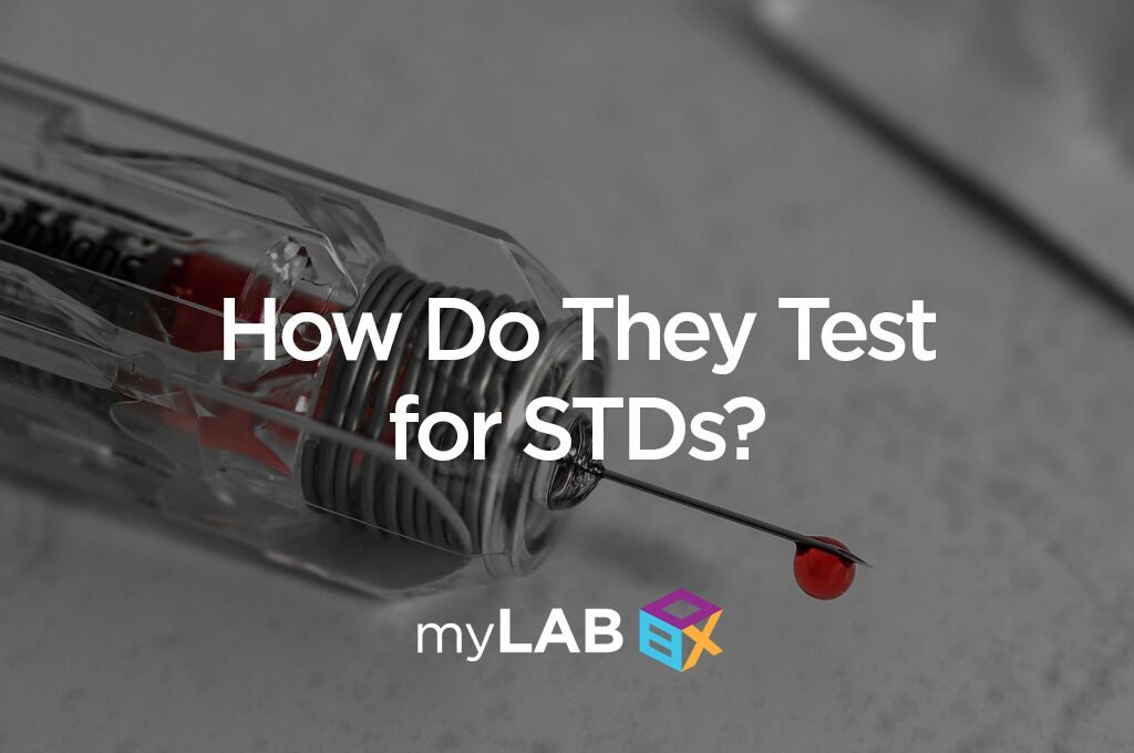 How Do They Test for STDs?