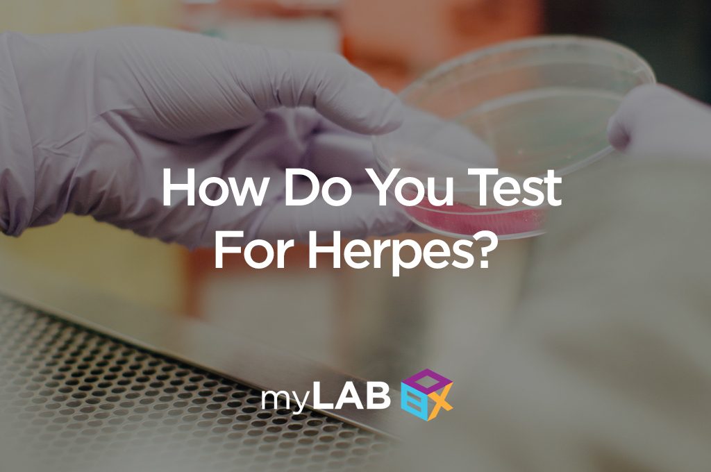 how do you test for herpes