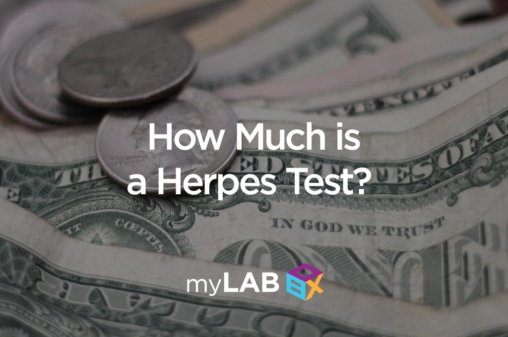 How Much is a Herpes Test?